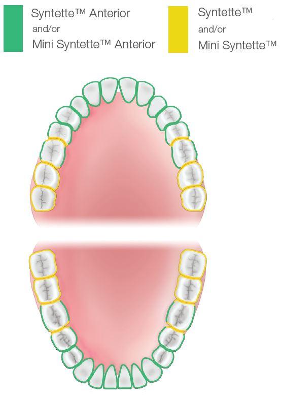 Dual gracey optimal treatment