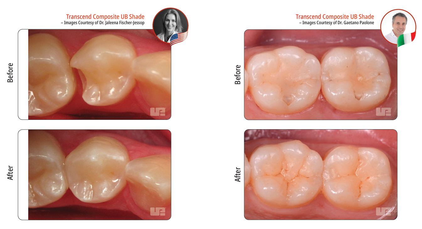 Transcend Clinical Cases 1