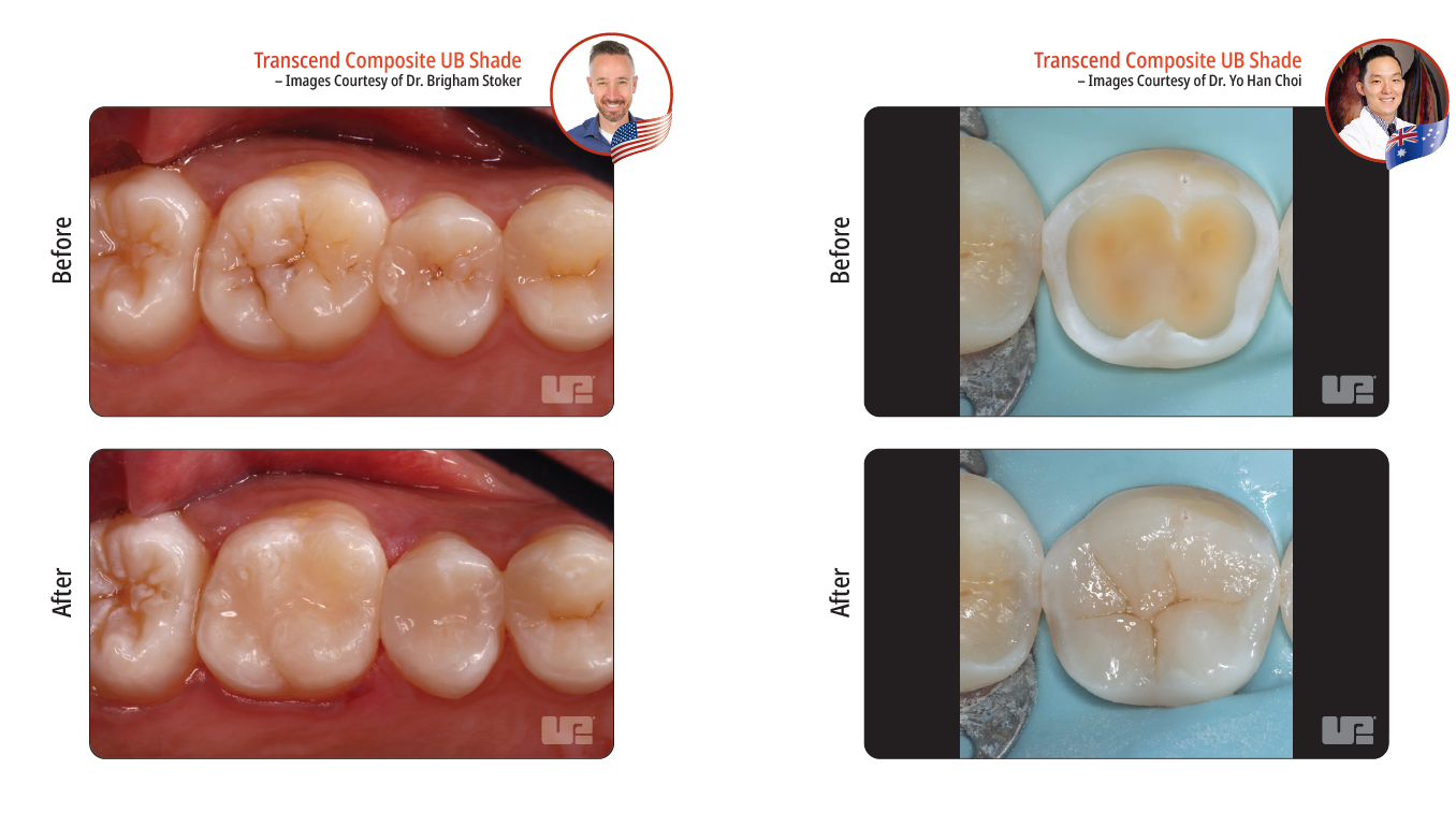 Transcend Clinical Cases 2