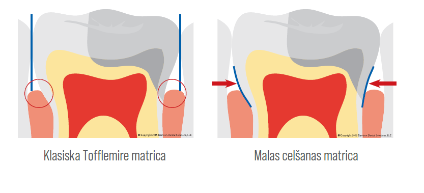 malas celsanas matrica 1