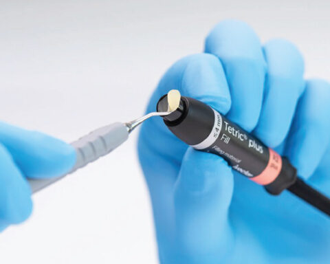 Atklāj jauno Ivoclar kompozītu – Tetric Plus!