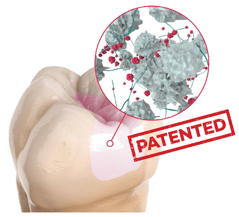 EQUIA Forte HT - unikālā hibrīdstikla tehnoloģija 1 2026 01 GC EquiaForte hibridstikla tehnologija 1
